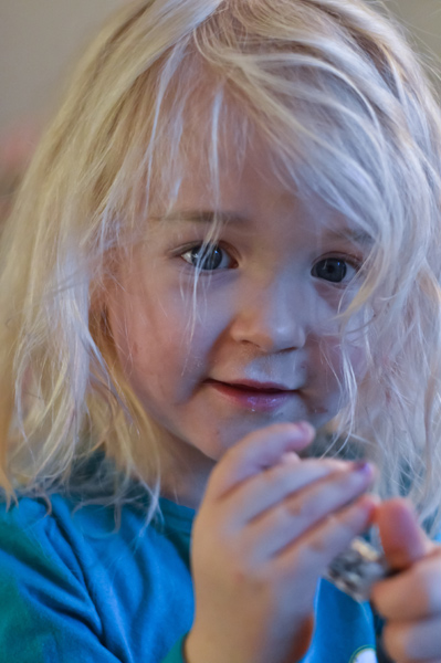 White or Grey Hair in Children: Causes & Managements 